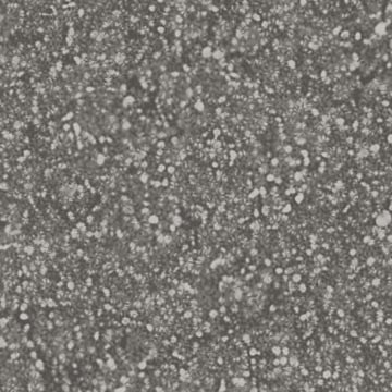 speckled static texture